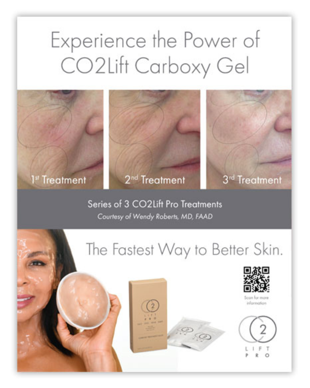 CO2Lift® Pro Carboxy Gel Masks - 3 Home Treatments