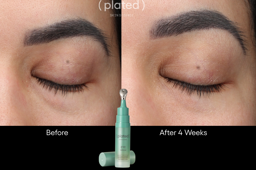 Plated Eye Serum - Renew Wellness & Aesthetics