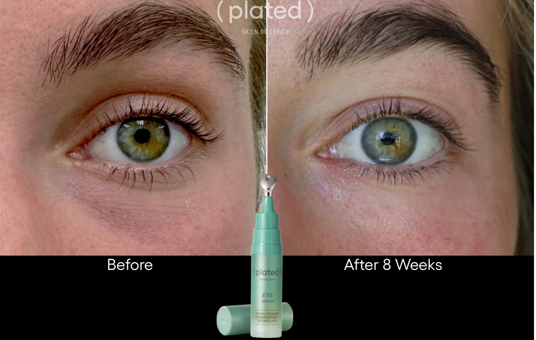 Plated Eye Serum - Renew Wellness & Aesthetics