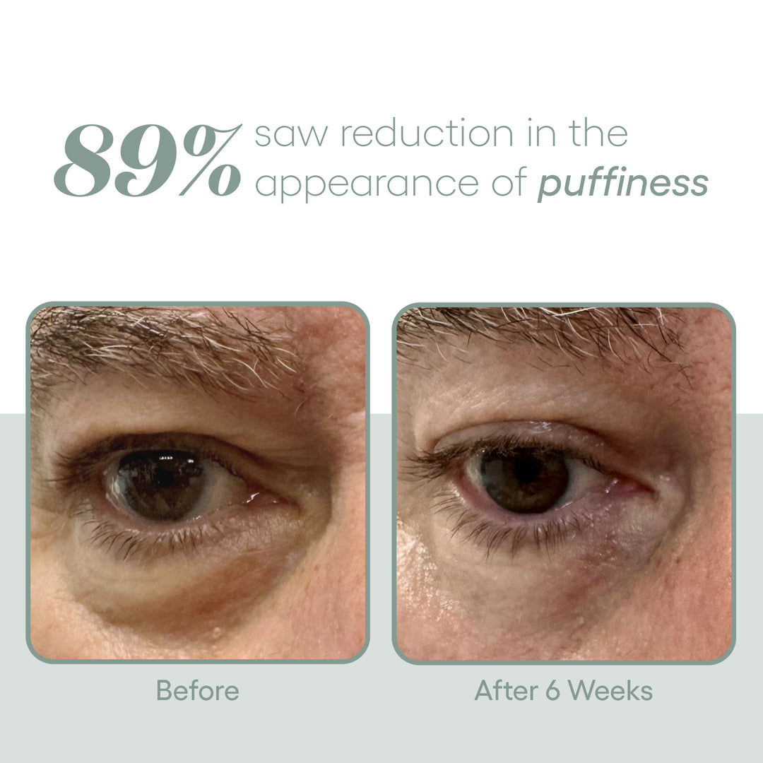 Plated Eye Serum - Renew Wellness & Aesthetics