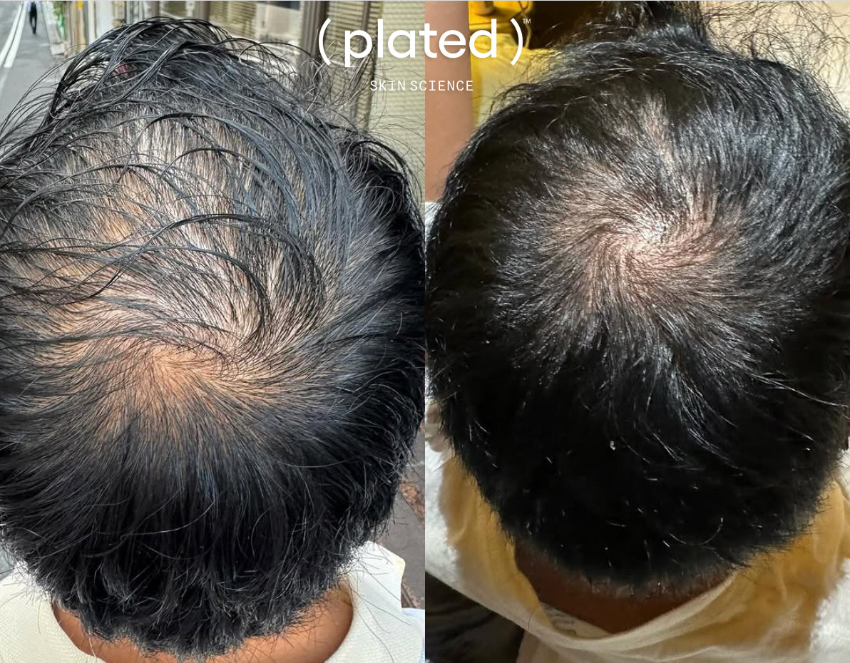 Plated Hair Serum - Renew Wellness & Aesthetics
