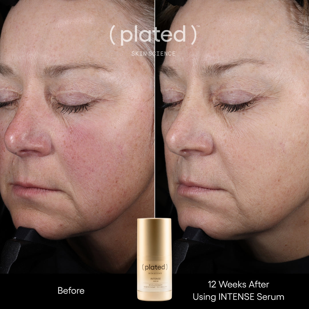 Plated Skin Science Intense Serum, Exosome Growth Factor Serum - Renew Wellness & Aesthetics