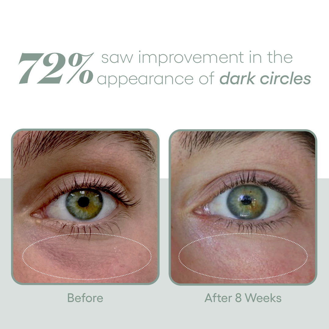 Plated Eye Serum - Renew Wellness & Aesthetics