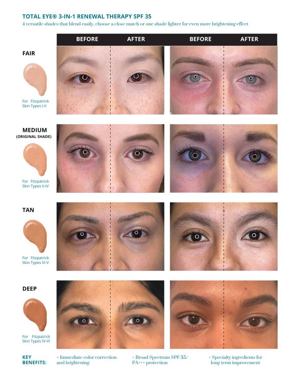 Colorescience Total Eye 3 - In - 1 Renewal Therapy SPF 35Eye Care - Renew Wellness & Aesthetics