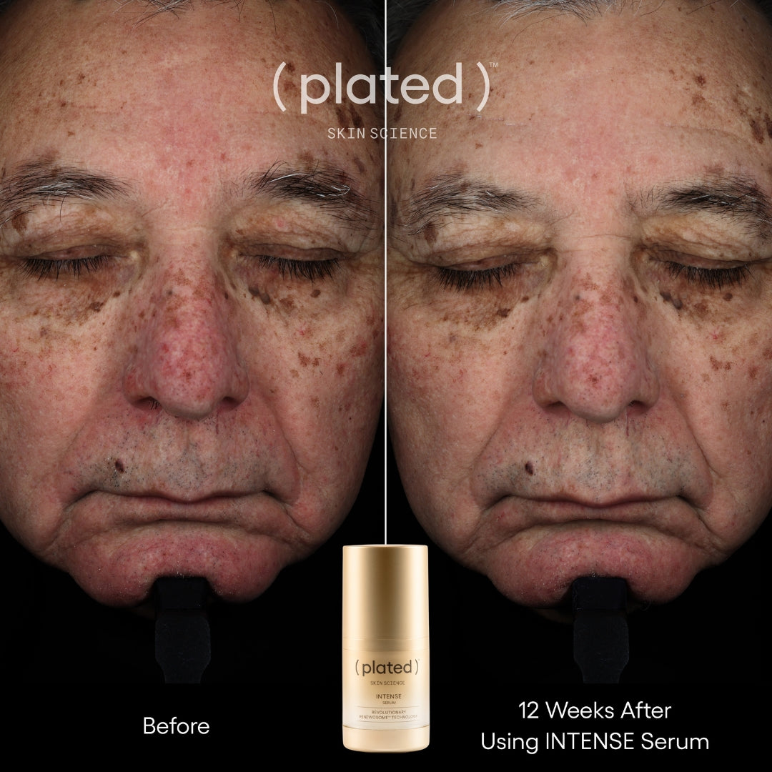 Plated Skin Science Intense Serum, Exosome Growth Factor Serum