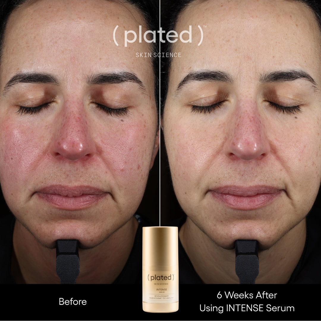 Plated Skin Science Intense Serum, Exosome Growth Factor Serum