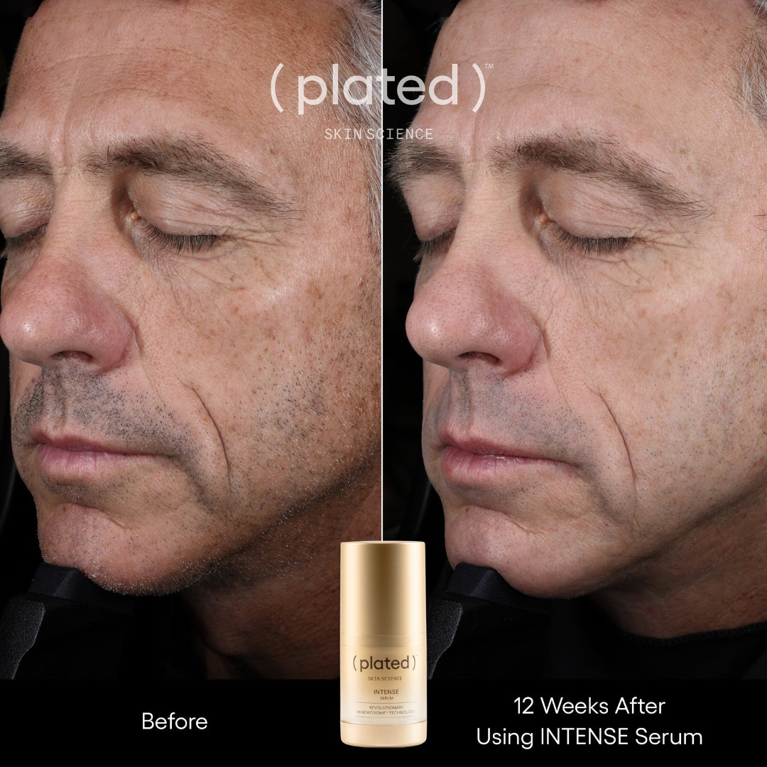 Plated Skin Science Intense Serum, Exosome Growth Factor Serum