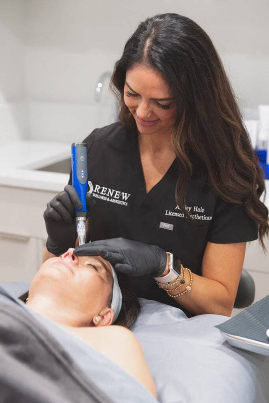 Microneedling with Exosomes or PRPProcedure - Renew Wellness & Aesthetics