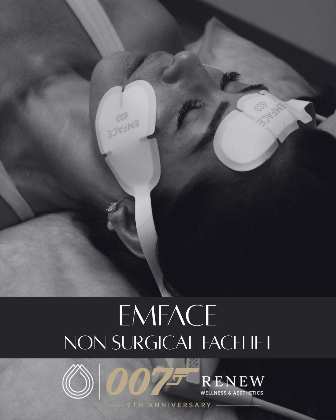 Emface Non-Surgical Facelift