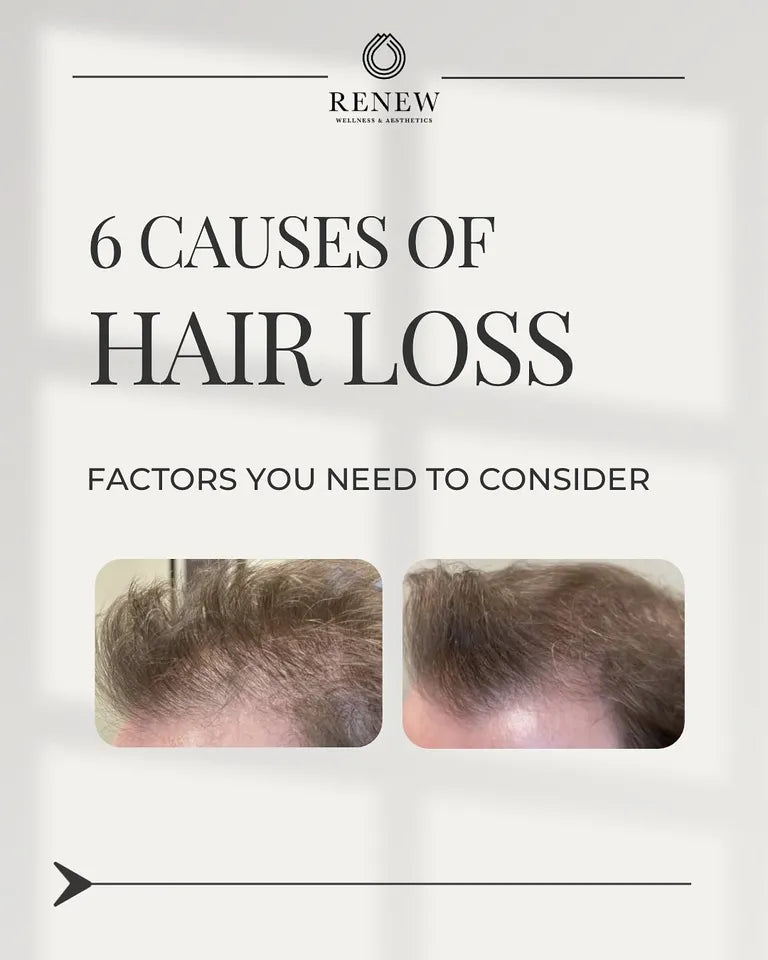 #tolstoy-video-preview-https%3A%2F%2Fvideos.gotolstoy.com%2Fpublic%2Ff00b0659-6105-4e34-b1ec-0586b7f2b7f7%2Fd52b3849-9dff-4cc5-8439-4193abd5e246%2Fd52b3849-9dff-4cc5-8439-4193abd5e246.mp4