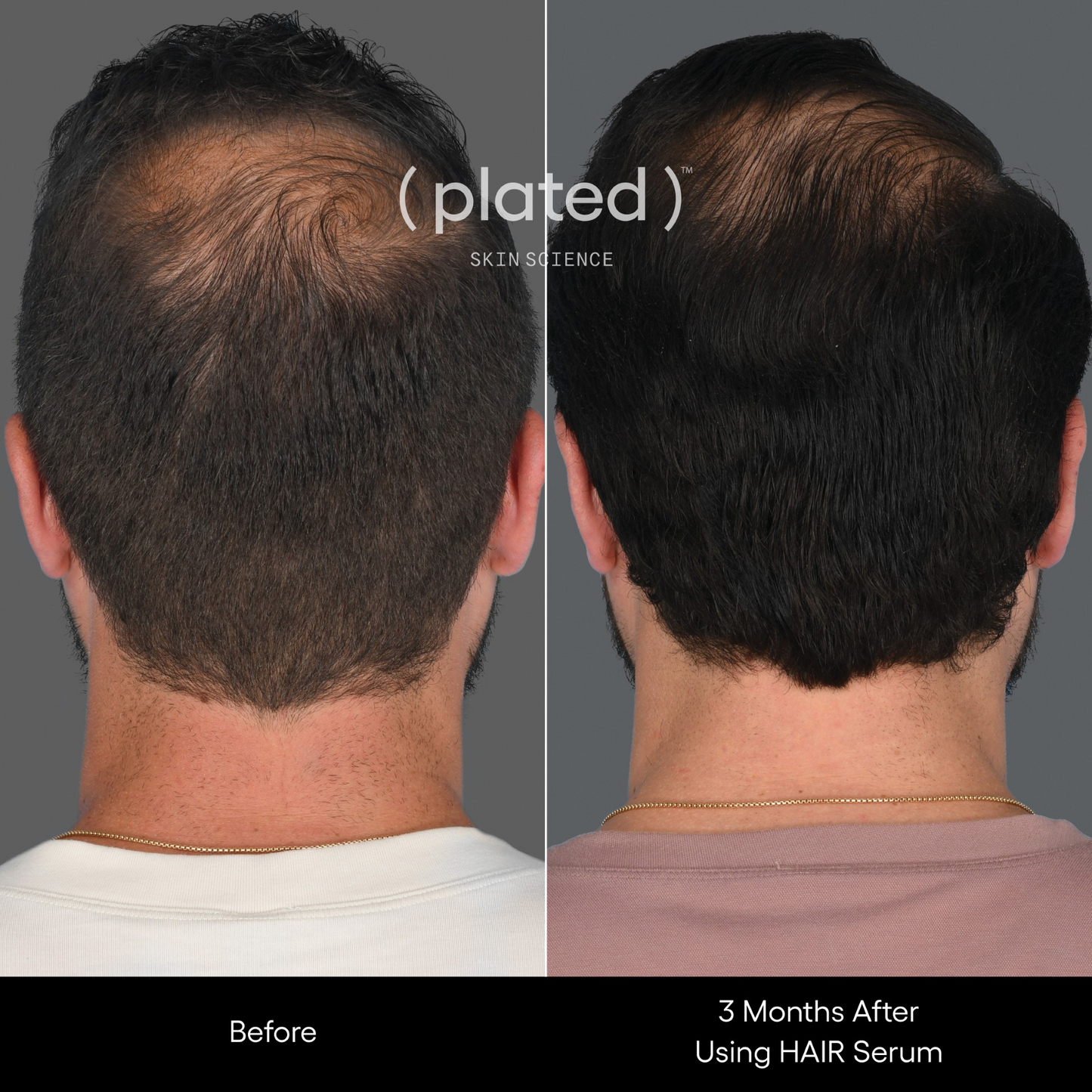 Plated Hair Serum - Renew Wellness & Aesthetics