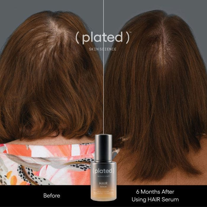 Plated Hair Serum - Renew Wellness & Aesthetics