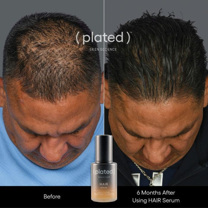 Plated Hair Serum - Renew Wellness & Aesthetics