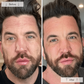 Omnilux Men LED Therapy Mask - Renew Wellness & Aesthetics 