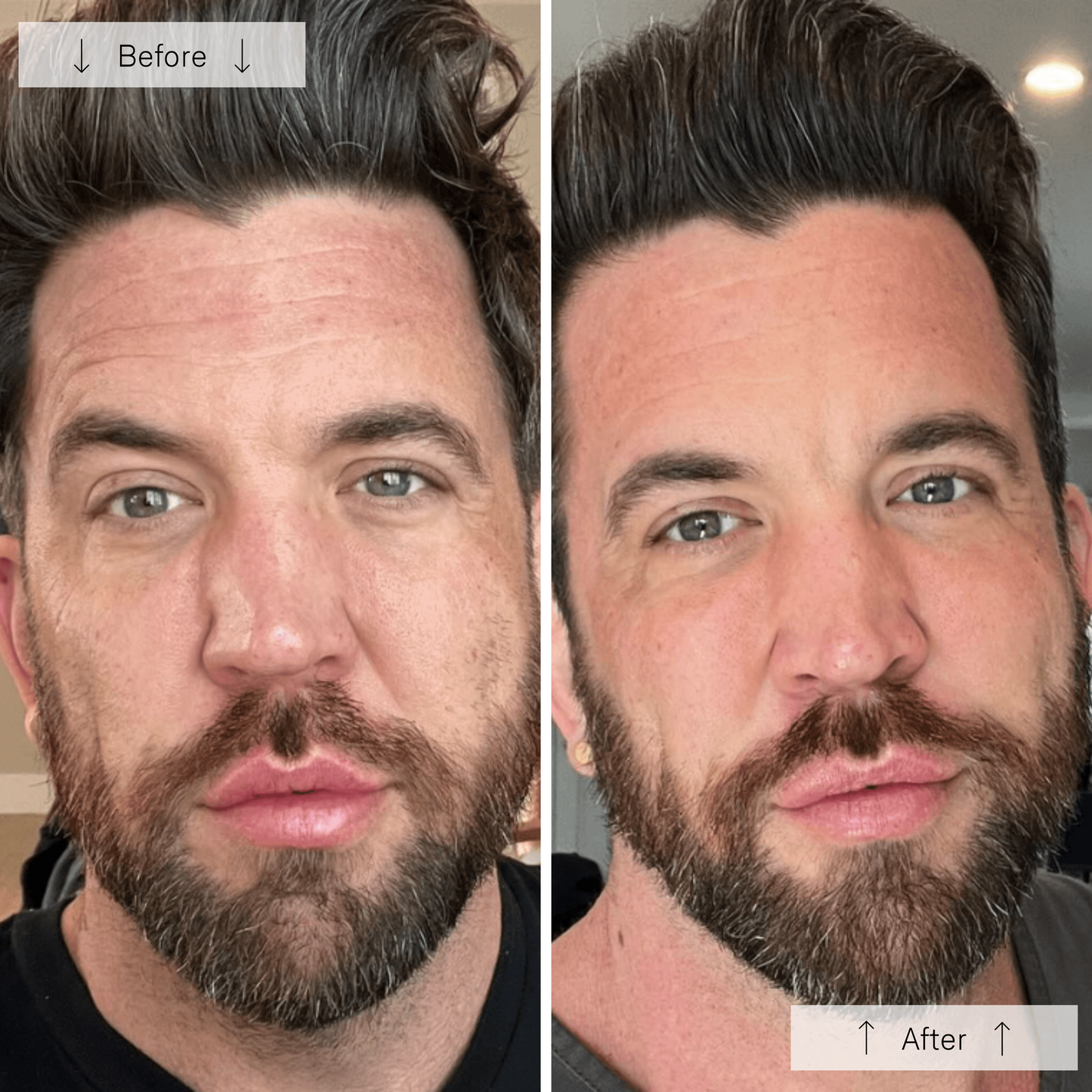 Omnilux Men LED Therapy Mask - Renew Wellness & Aesthetics 