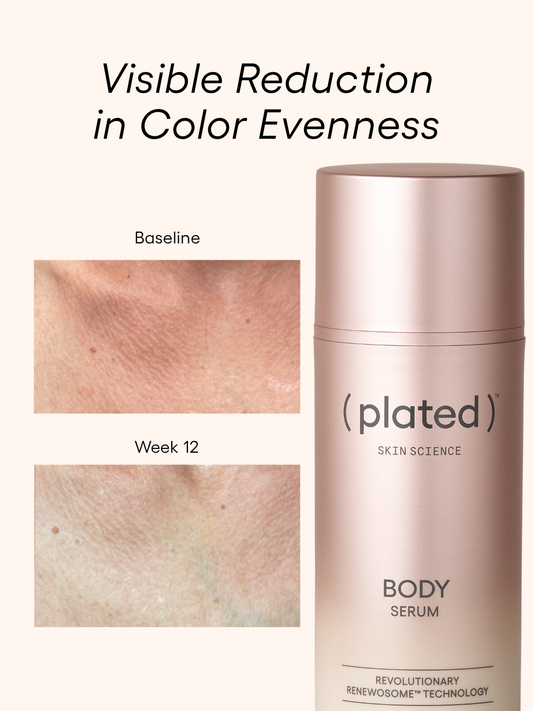 Plated Body Box
