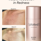 Plated Body Bundle