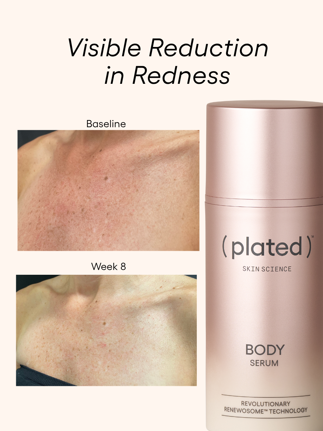 Plated Body Bundle