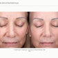 Sciton Tribrid Laser-Ultimate Skin Renewal