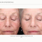 Sciton Tribrid Laser-Ultimate Skin Renewal