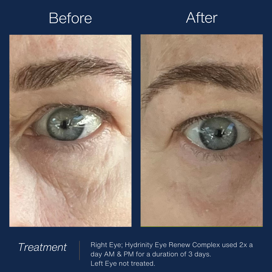 Hydrinity Eye Renew Complex