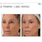 Sciton Tribrid Laser-Ultimate Skin Renewal