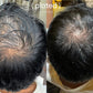 Plated Hair Serum - Renew Wellness & Aesthetics 