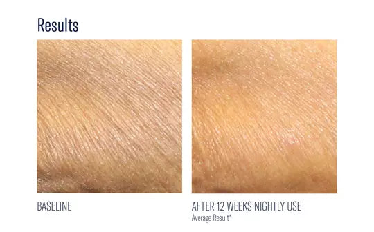 Skinbetter Science Alpharet Body Overnight Cream