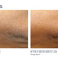 Skinbetter Science Alpharet Body Overnight Cream