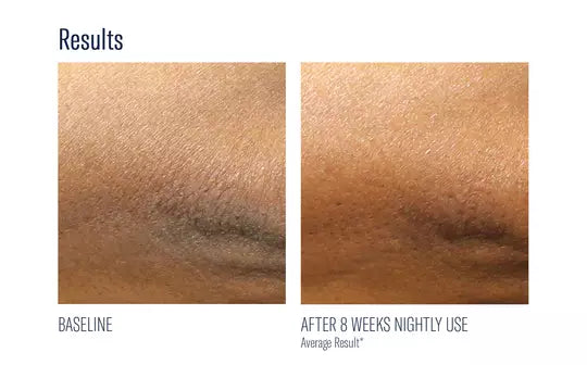 Skinbetter Science Alpharet Body Overnight Cream