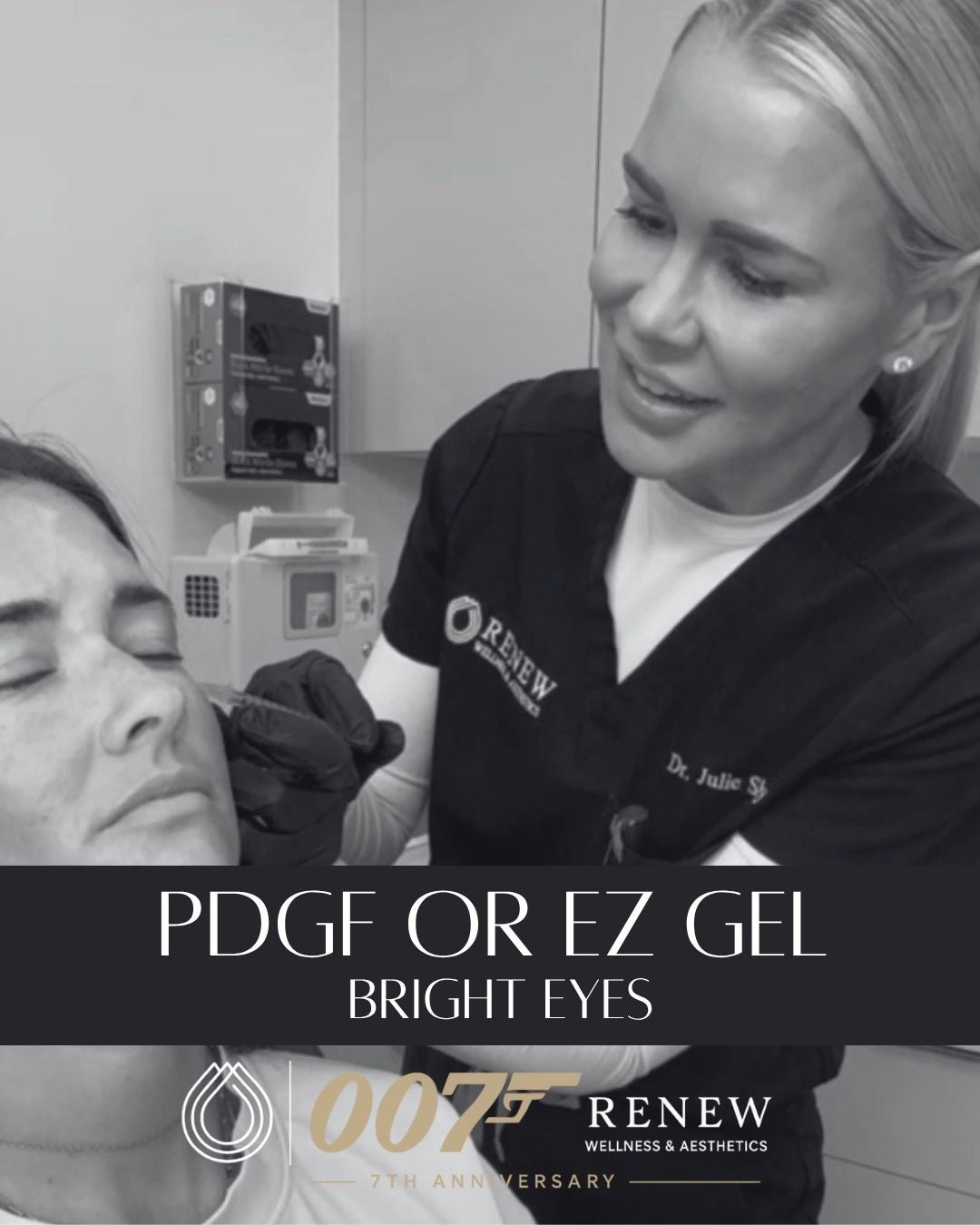 Under Eye Treatment (PDGF & EZ Gel)- BRIGHT EYES