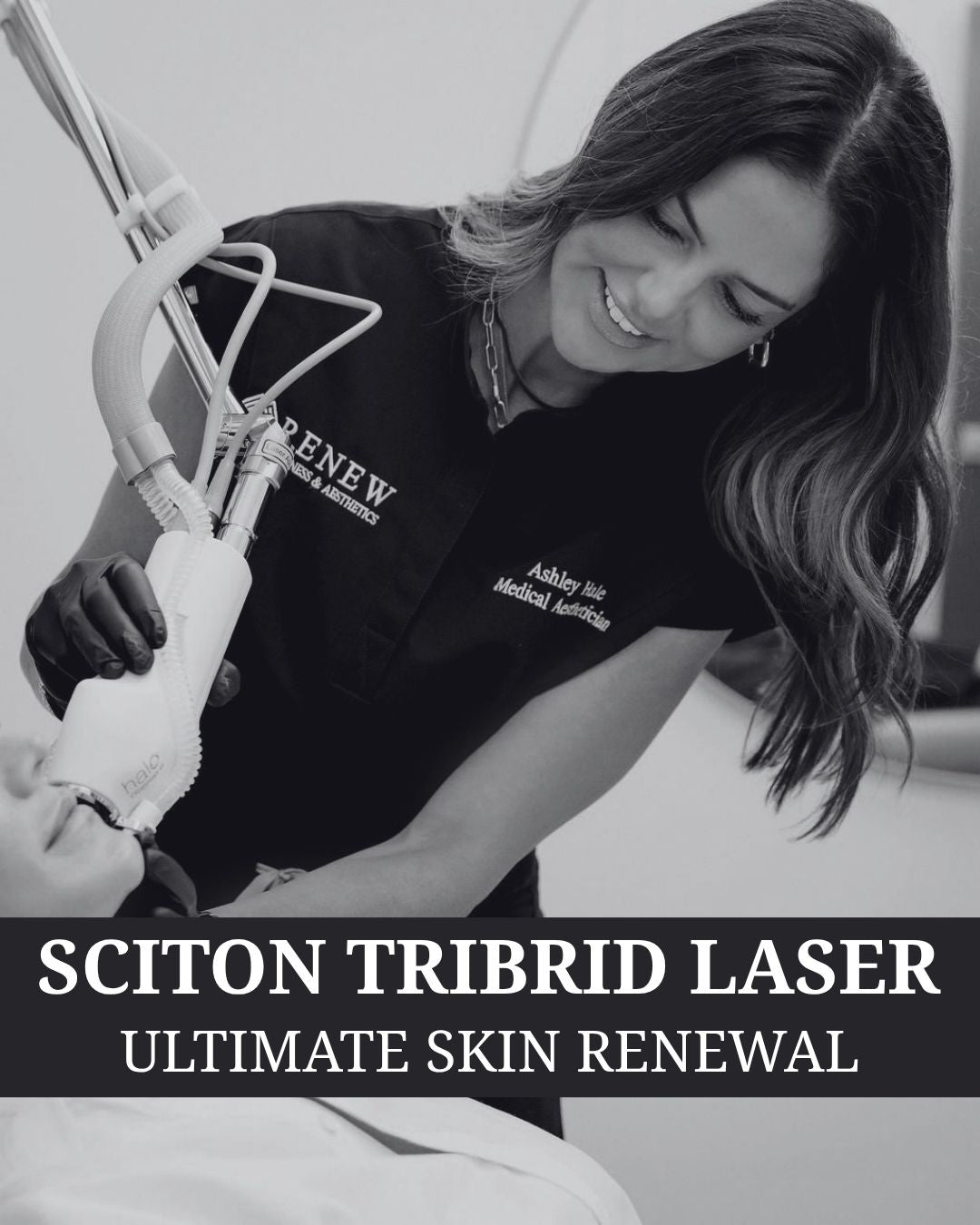 Sciton Tribrid Laser-Ultimate Skin Renewal