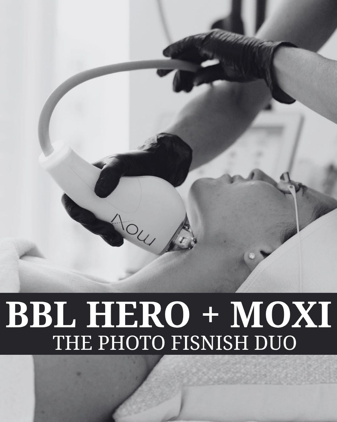 The Photo Finish Duo - BBL Hero + Moxi
