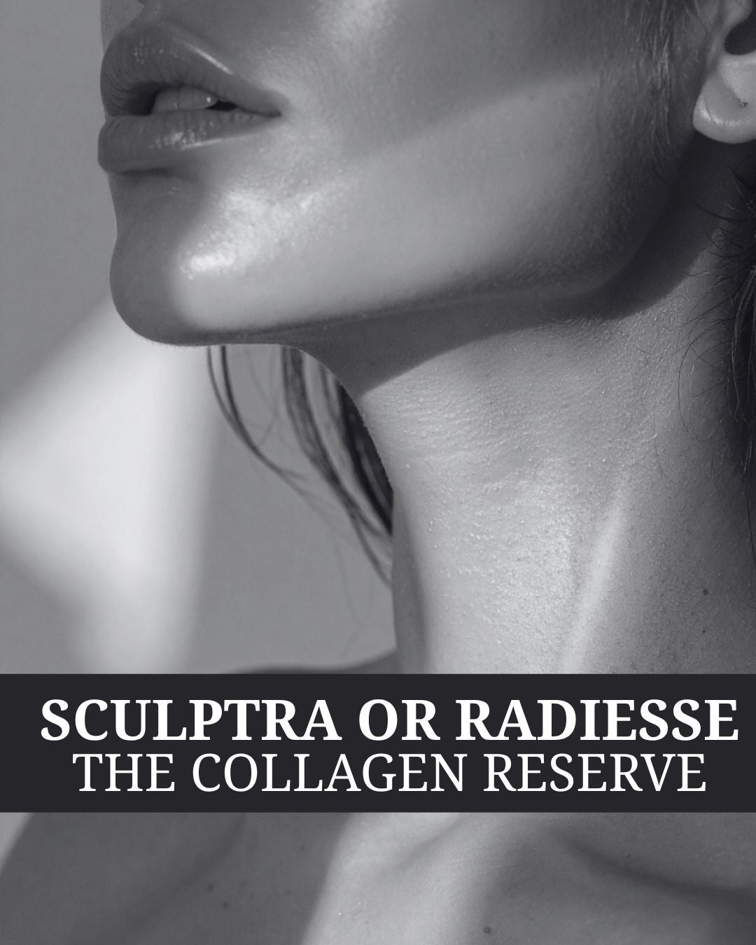 Collagen Reserve - Biostimulator Package (Sculptra or Radiesse)