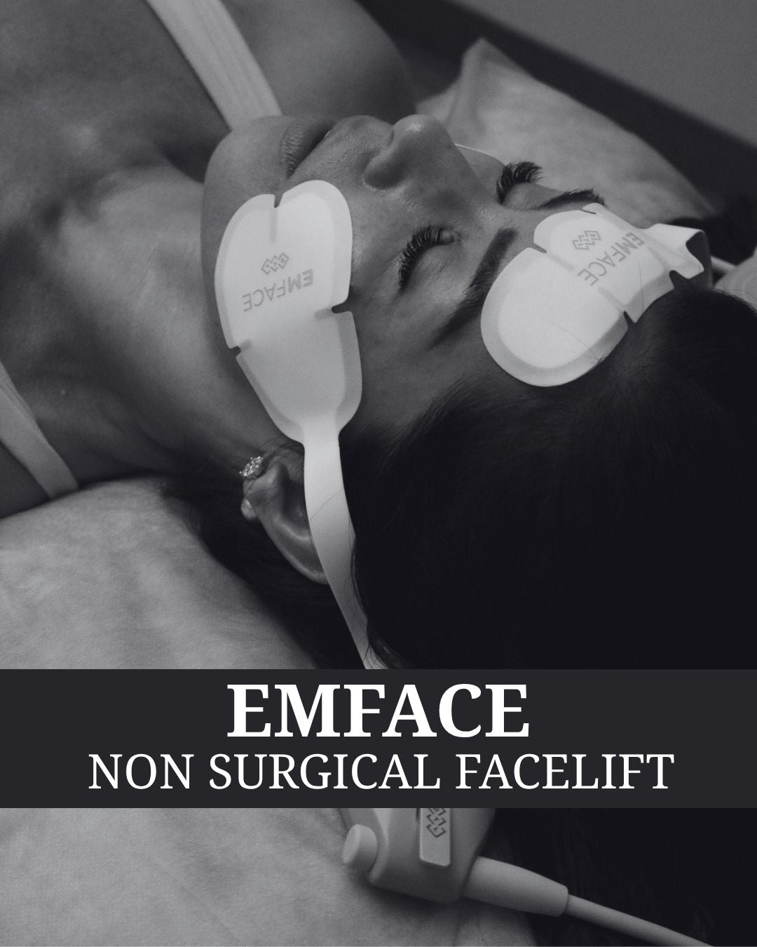 Emface Non-Surgical Facelift