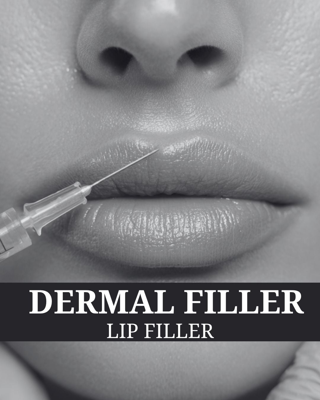 Dermal Filler