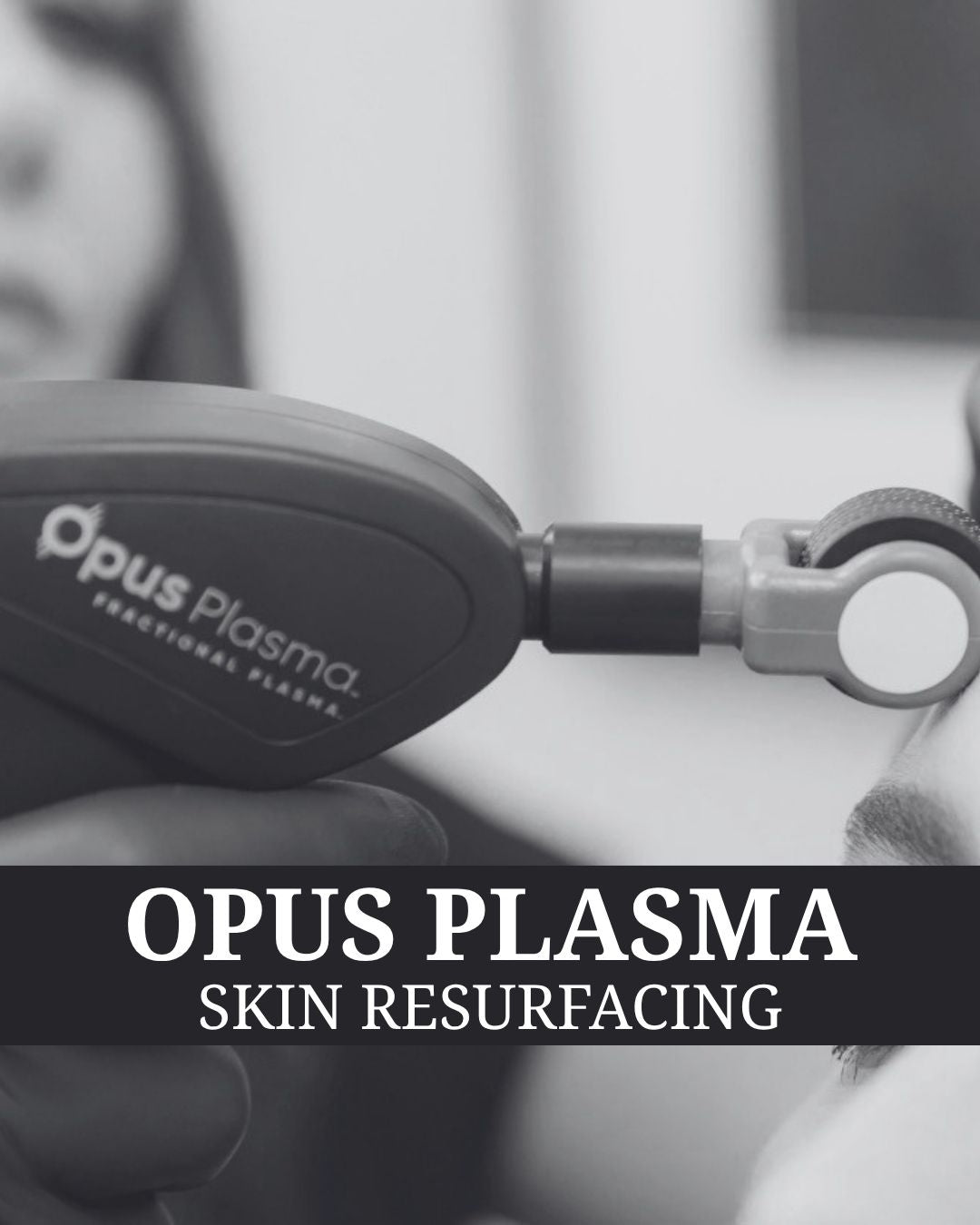 Opus Plasma Laser Resurfacing
