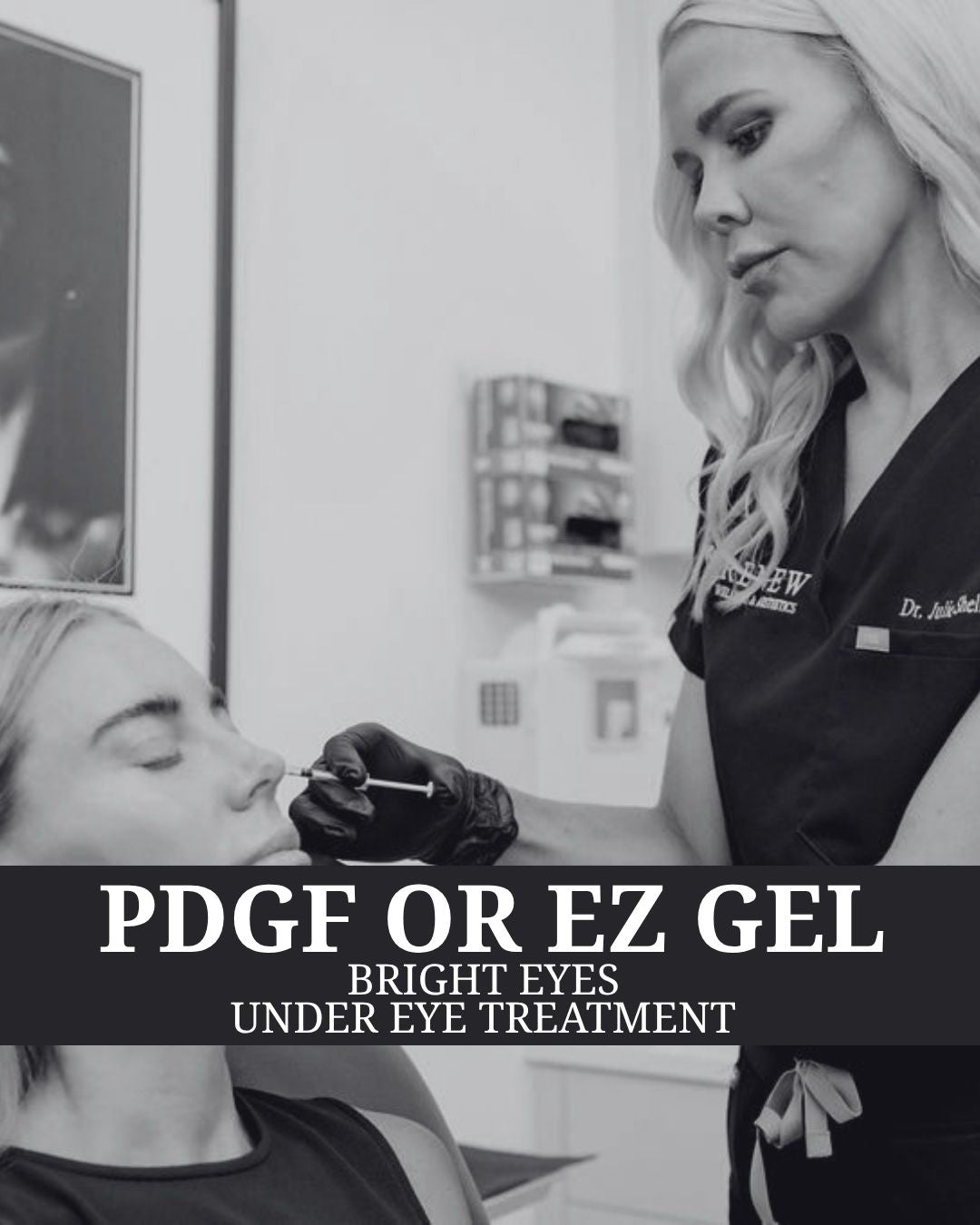 Under Eye Treatment (PDGF & EZ Gel)- BRIGHT EYES