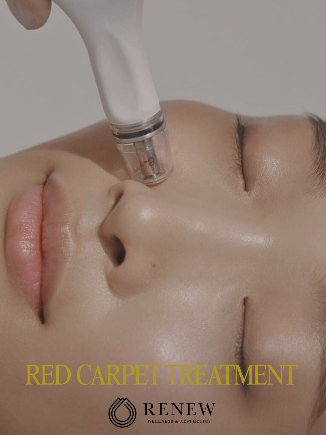 The Red Carpet Treatment