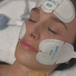 Emface Non-Surgical Facelift