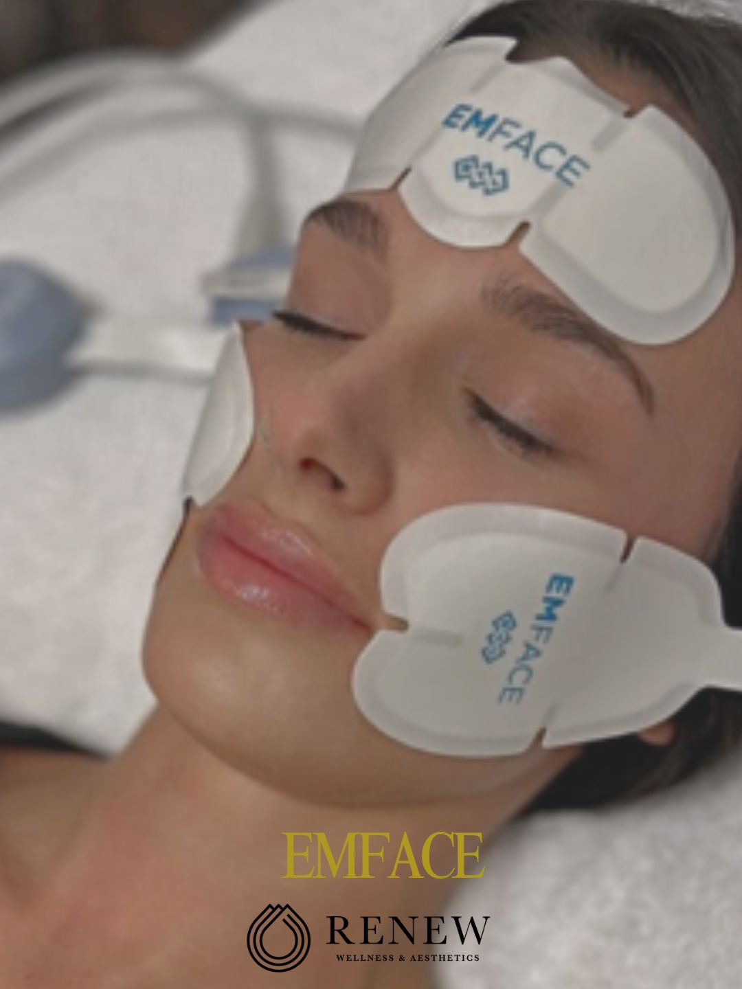 Emface Non-Surgical Facelift