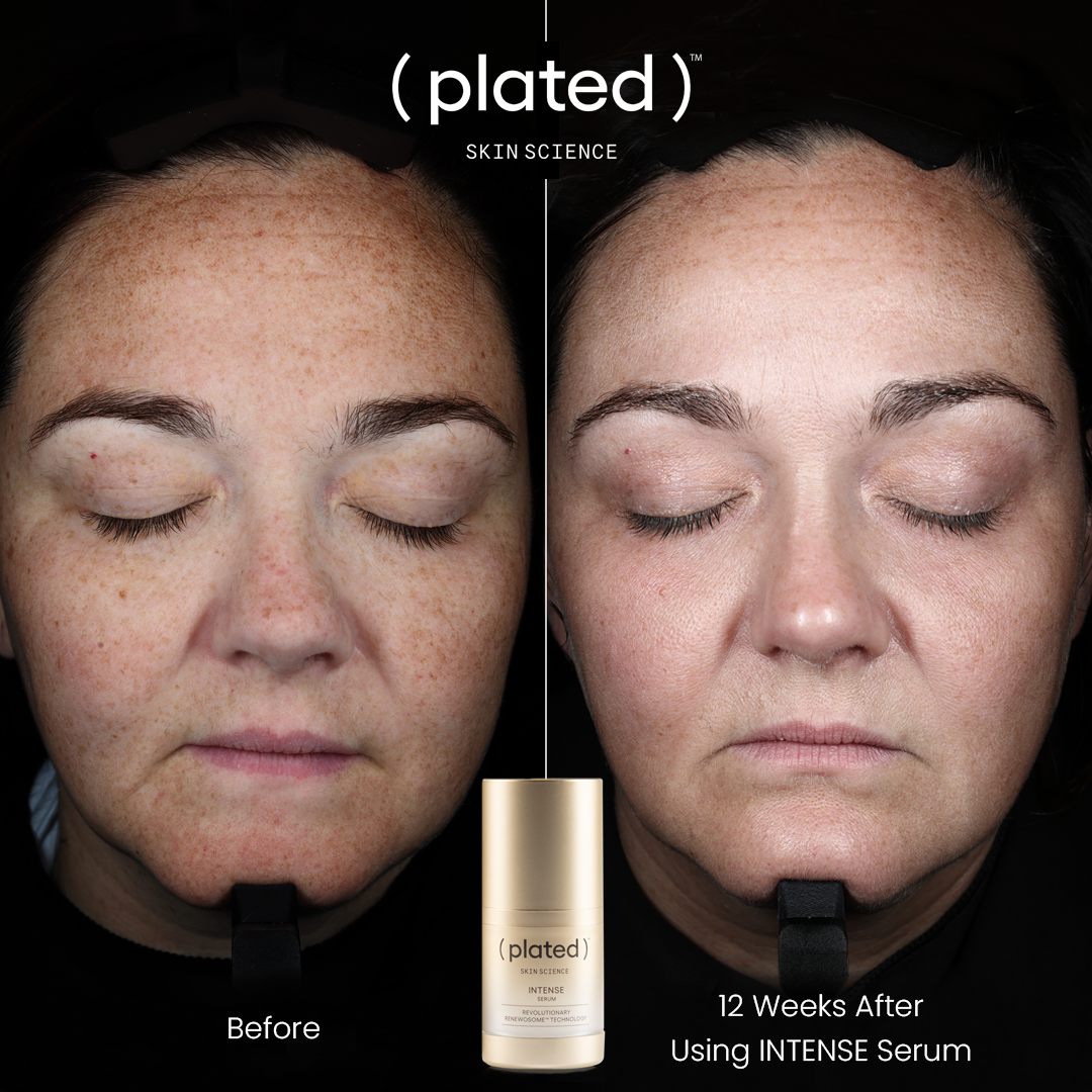 Plated Skin Science Intense Serum, Exosome Growth Factor Serum - Renew Wellness & Aesthetics 
