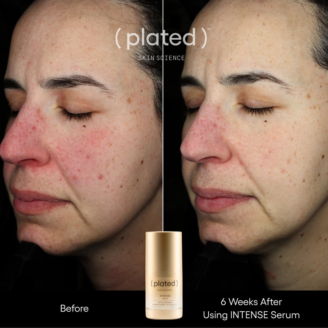 Plated Skin Science Intense Serum, Exosome Growth Factor Serum - Renew Wellness & Aesthetics 