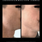 Men, do you want to age backwards FROM HOME? Your skin is 25% thicker. That means it demands treatments that work harder and penetrate deeper. The Omnilux Men Red Light Therapy Mask is FDA-approved and specifically engineered to: 

💪🏼 Reduce Wrinkles
💪🏼 Minimize Eye Bags
💪🏼 Calm Post-Shave Irritation 
💪🏼 Fade Dark Spots
💪🏼 Improve Skin Texture

Shop the link above! Pick-up in store or ship with UPS! 

#OmniluxMen #RedLightTherapy #MensSkincare