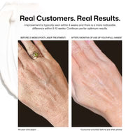 Revision Youthful Hand - Renew Wellness & Aesthetics 