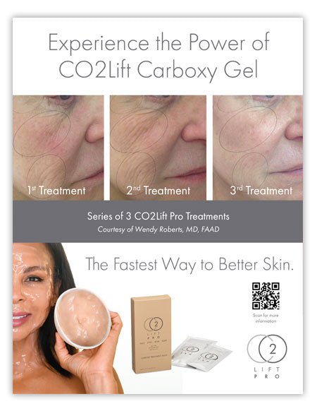 CO2Lift® Pro Carboxy Gel Masks - 3 Home TreatmentsAnti - Aging - Renew Wellness & Aesthetics