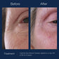 Hydrinity Eye Renew ComplexEye Care - Renew Wellness & Aesthetics