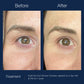 Hydrinity Eye Renew ComplexEye Care - Renew Wellness & Aesthetics