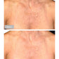 Omnilux Contour for Neck & Decollete LED Therapy DeviceAnti - Aging - Renew Wellness & Aesthetics