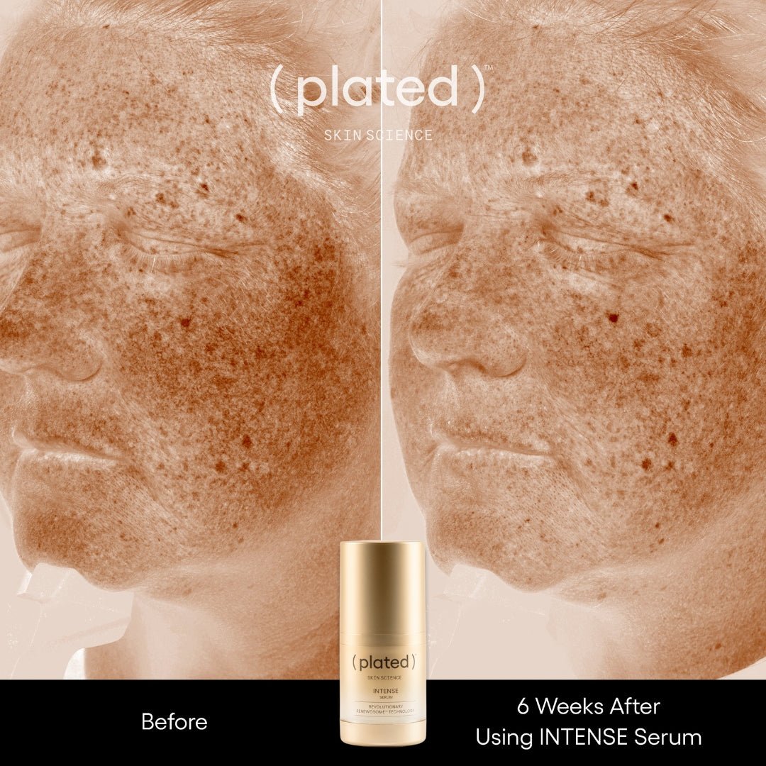 Plated Skin Science Intense Serum, Topical Exosome Growth Factor SerumAnti - Aging - Renew Wellness & Aesthetics